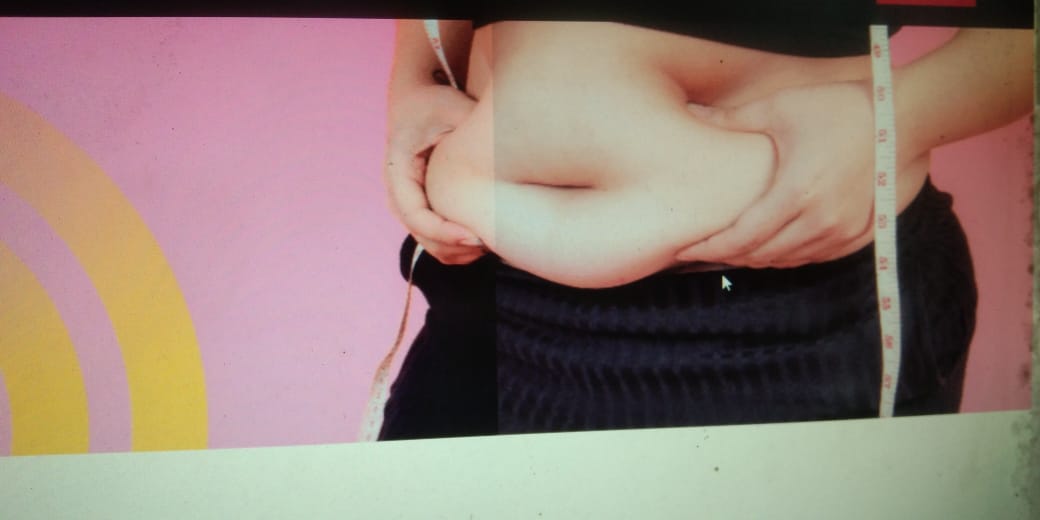 Ini 5 Cara Mengecilkan Perut Buncit